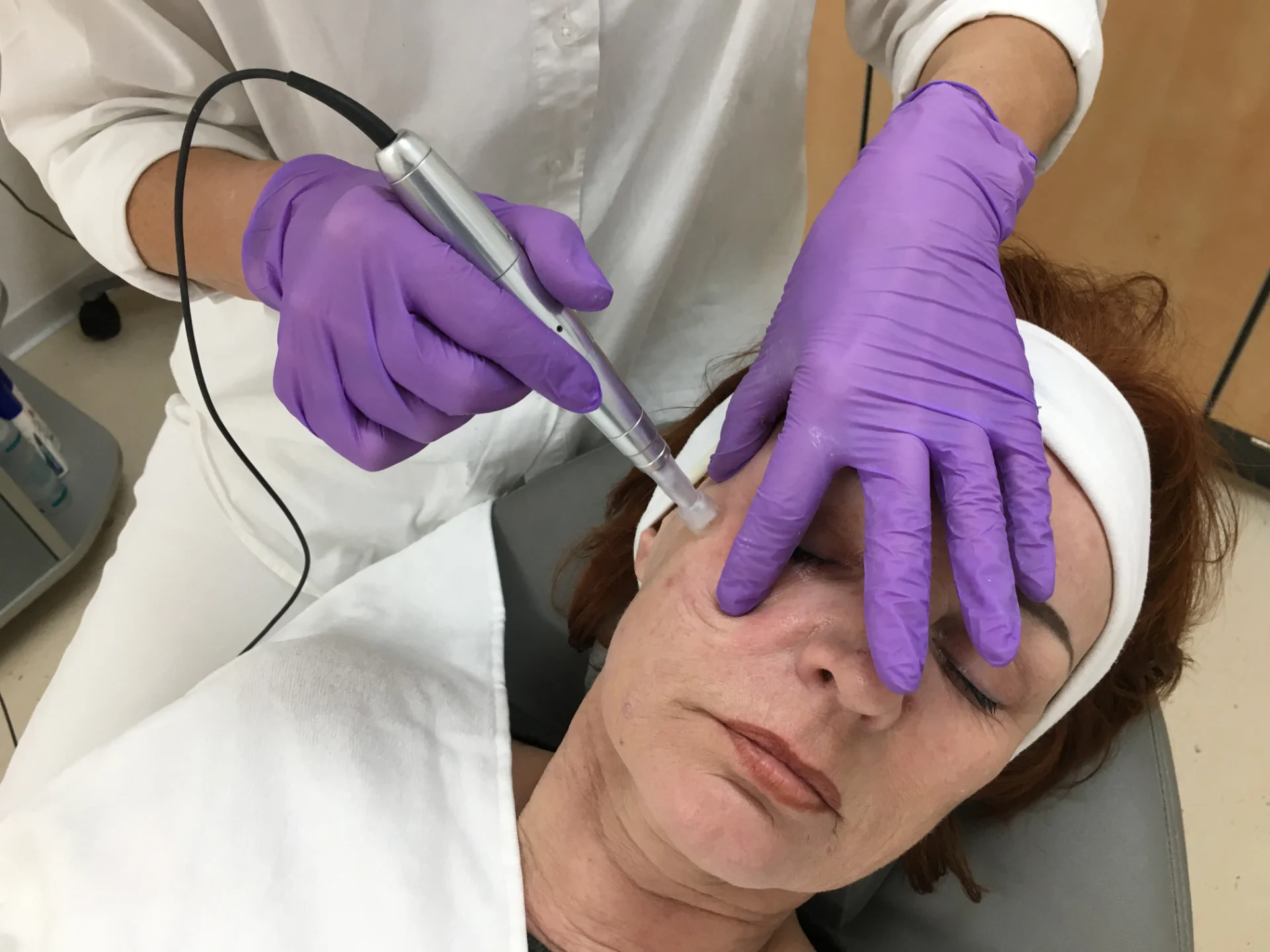 EXO MESOLIFT: Microneedling-Behandlung im Studio von wellness & beauty in Straubing